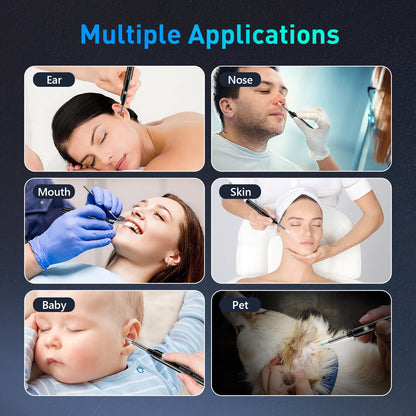 Ear Wax Removal: detects motiond Wireless Ear Cleaner Tool Set with 1080P HD Ear Scope, Ear Camera for iPhone, iPad & Android Phones