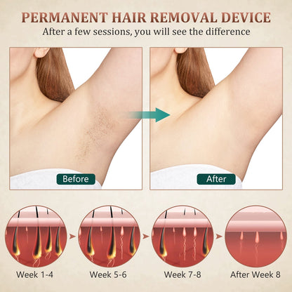 Laser Hair Removal with Cooling System Green Painless Permanent Hair Remover for Full Body Hair